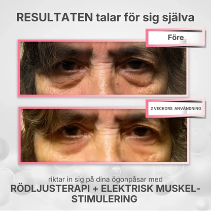 LumiFrame® 2-i-1  Rödljus Terapi + EMS för att radera ögonpåsar